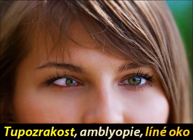 amblyopie-tupozrakost-priznaky-projevy-symptomy