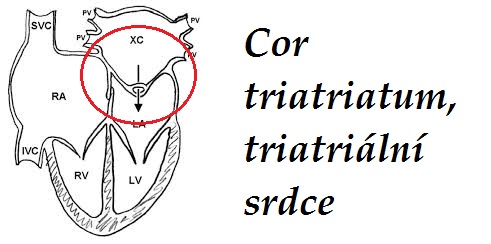 cor-triatriatum-triatrialni-srdce-priznaky-projevy-symptomy