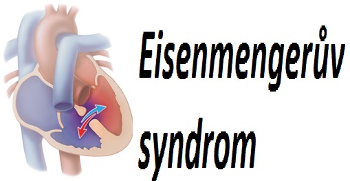 eisenmengeruv-syndrom-priznaky-projevy-symptomy