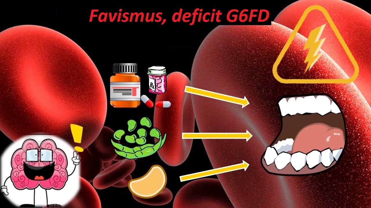 Favismus deficit G6PD deficit glukóza 6 fosfát dehydrogenázy příznaky projevy příčina léčba