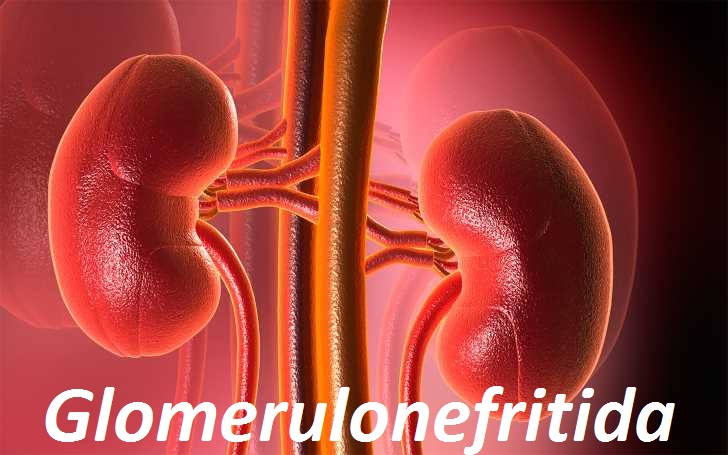 Zánět ledvin glomerulonefritida glomerulonefritis příznaky projevy symptomy příčina léčba