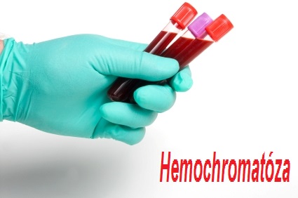 hemochromatoza-priznaky-projevy-symptomy