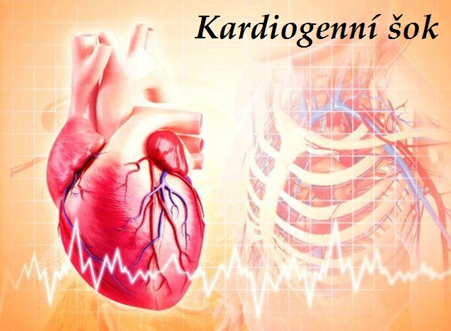 kardiogenni sok priznaky projevy symptomy