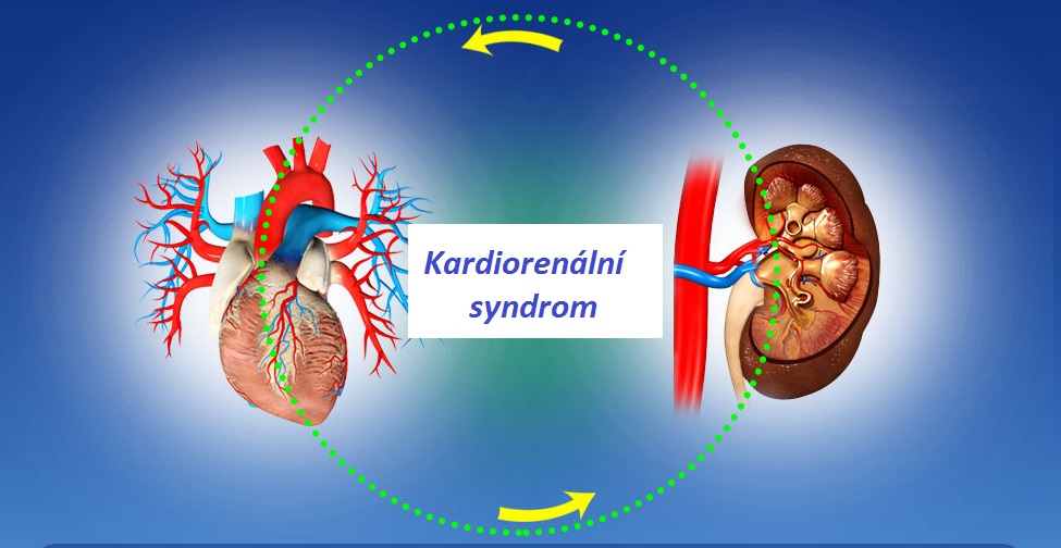 Kardiorenální syndrom příznaky projevy symptomy příčina léčba