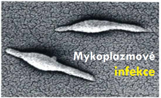 mykoplazmova-infekce-mykoplazmata-priznaky-projevy-symptomy-9