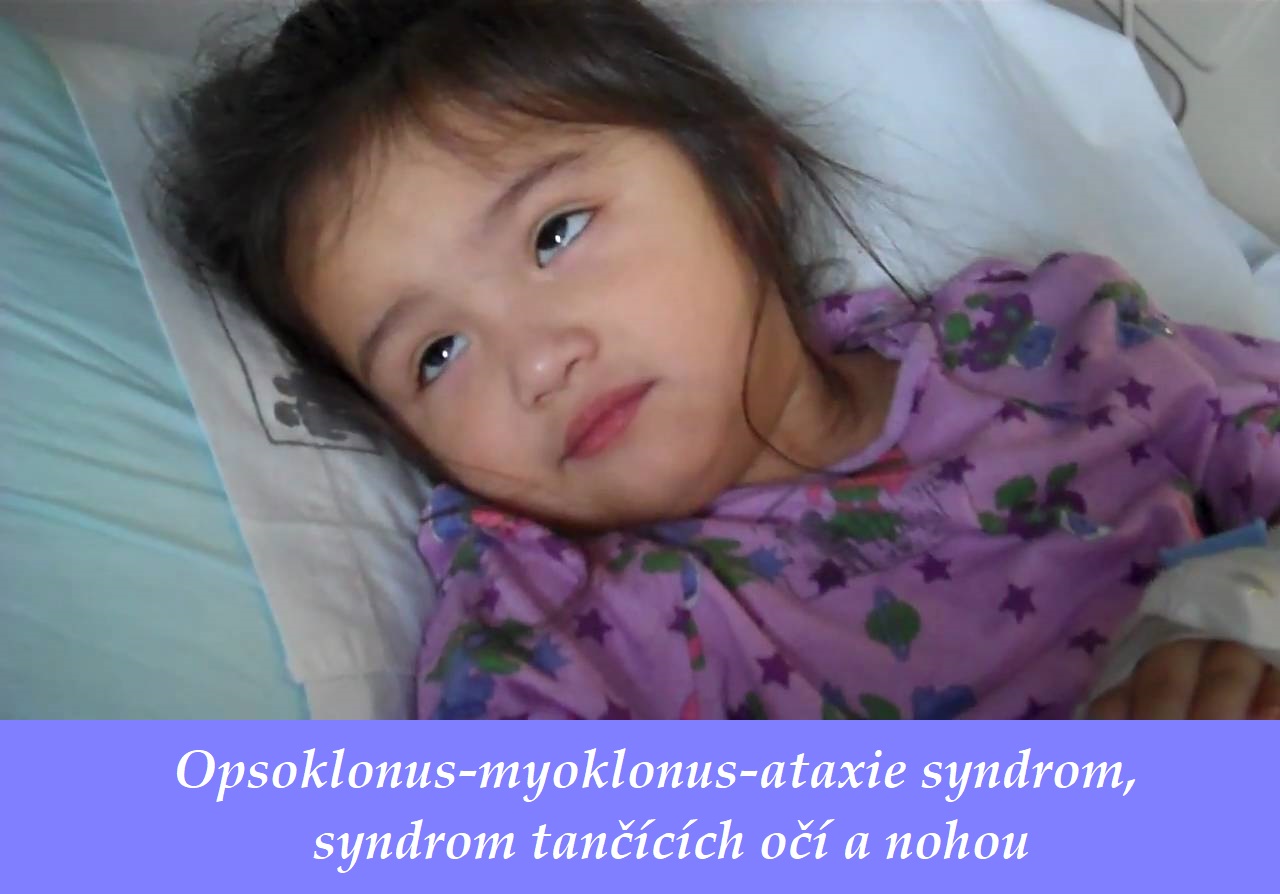 Opsoklonus myoklonus ataxie syndrom příznaky projevy příčina léčba
