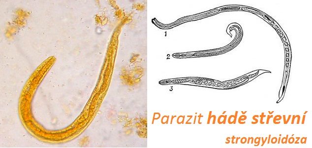 parazit-hade-strevni-strongyloidoza-priznaky-projevy-symptomy-obrazek-fotografie
