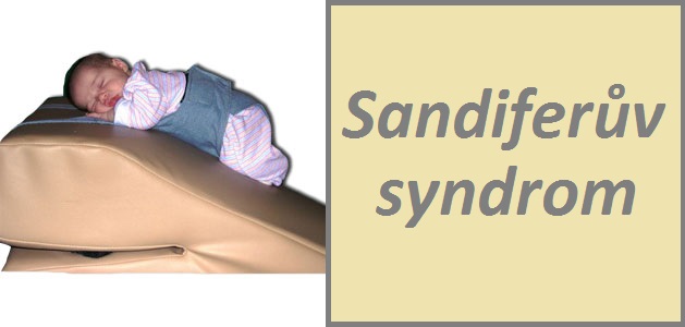 sandiferuv-syndrom-priznaky-projevy-symptomy