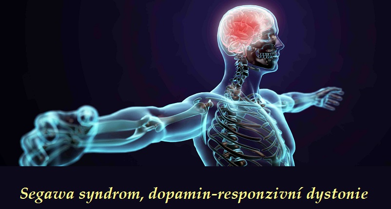 segawa syndrom dopamin responzivni dystonie priznaky projevy symptomy