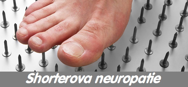 shorterova-neuropatie-priznaky-projevy-symptomy
