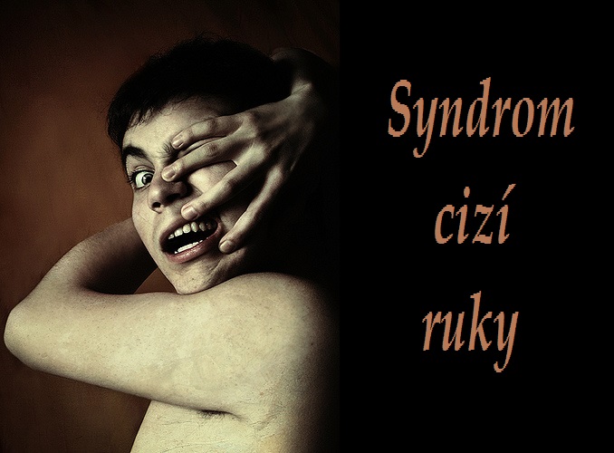 syndrom-cizi-ruky-priznaky-projevy-symptomy