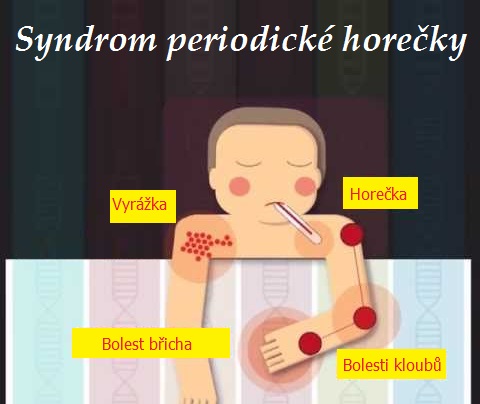 syndrom periodicke horecky marschaluv syndrom syndrom pfapa priznaky projevy symptomy