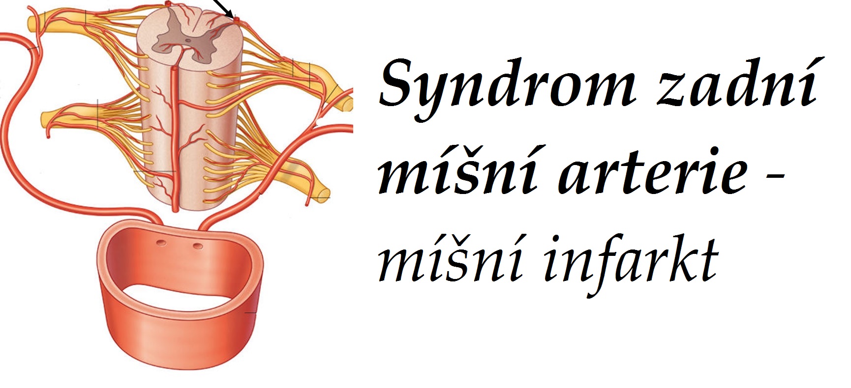 syndrom-zadni-misni-arterie-priznaky-projevy-symptomy