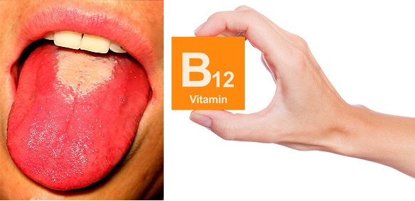 ucinky-vitaminu-b12-nedostatek-vitaminu-b12-priznaky-projevy-symptomy