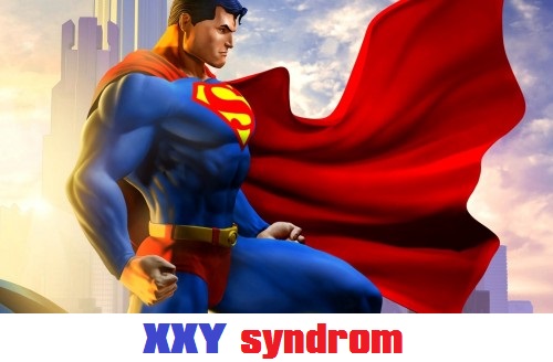 xyy-syndrom-syndrom-supermuze-priznaky-projevy-symptomy