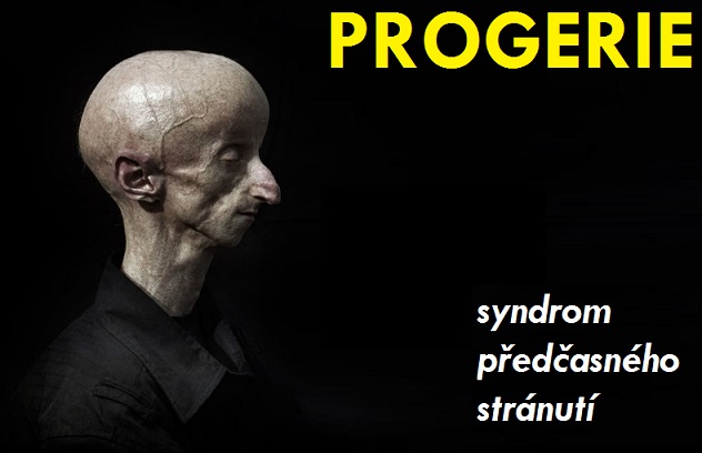 progerie-syndrom-predcasneho-starnuti-priznaky-projevy-11