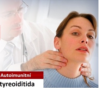 autoimunitni-tyreoiditida-priznaky-projevy-symptomy copy