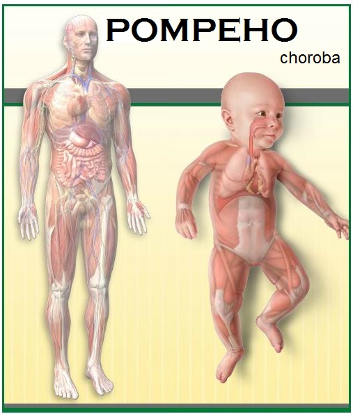 pompeho-choroba-nemoc-priznaky-projevy-symptomy-2