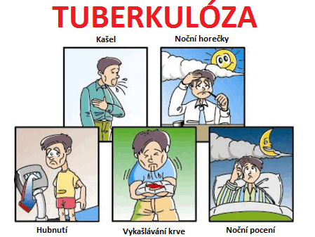 tuberkuloza-souchotiny-ubyte-priznaky-projevy-symptomy